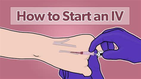 Starting Iv Techniques