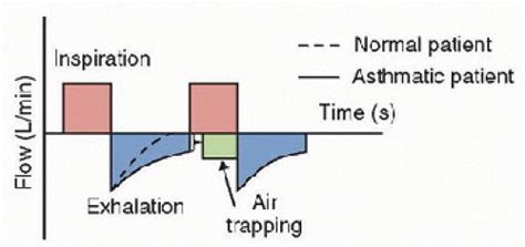 Status Asthmaticus Time