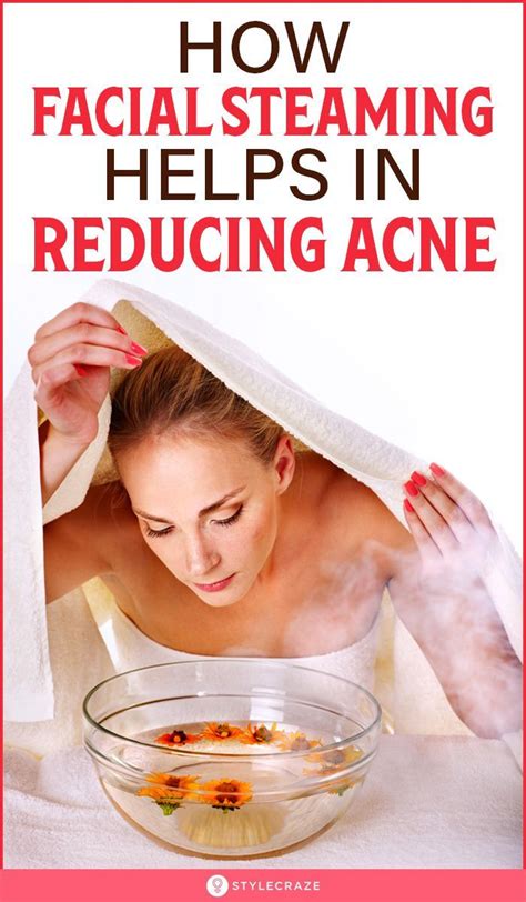 Steaming Face Acne Reddit