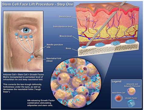 Stem Cell Cosmetic Surgery: The Ultimate Guide to Regenerative Aesthetics