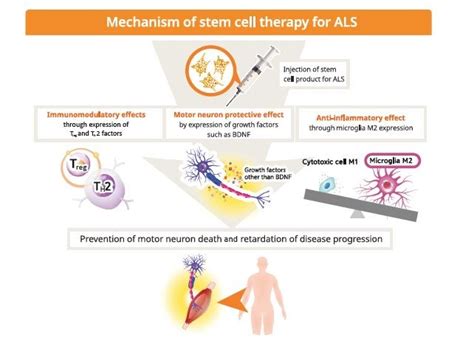 stem cell therapy for als patients