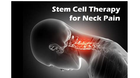 stem cell therapy for neck pain near me