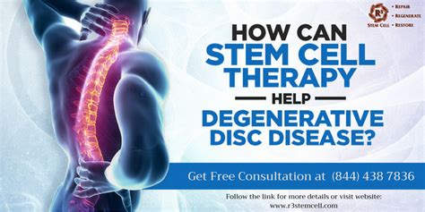 stem cell therapy new york