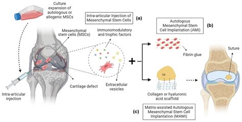 stem cell treatment in ct