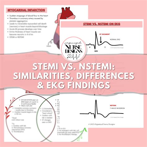 stemi vs nstemi which is worse