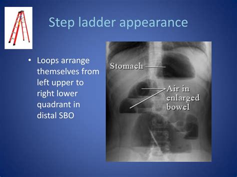 Step Ladder Radiology