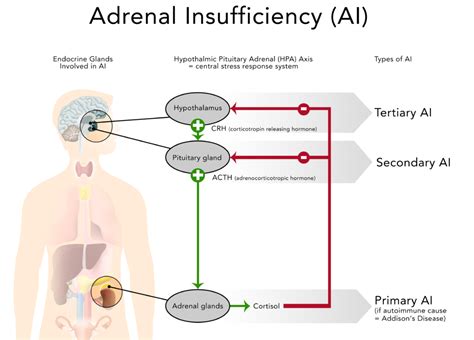 steroid use and adrenal insufficiency