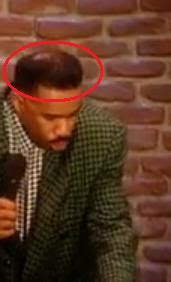 steve harvey hair loss