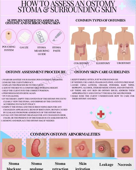 Stoma Nursing Notes