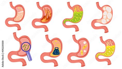 Stomach Nausea When Empty