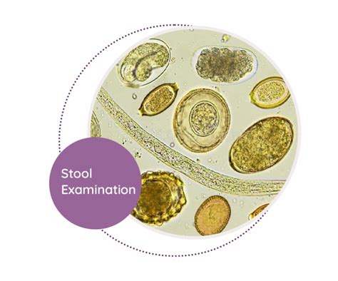Stool Direct Examination