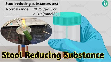 Stool Examination Ph & Reducing Substances