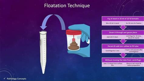 Stool Flotation Technique