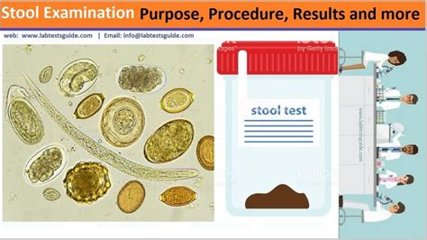 Stool General Examination