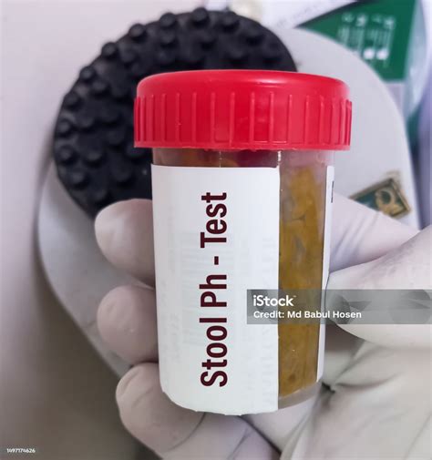Stool Ph Test