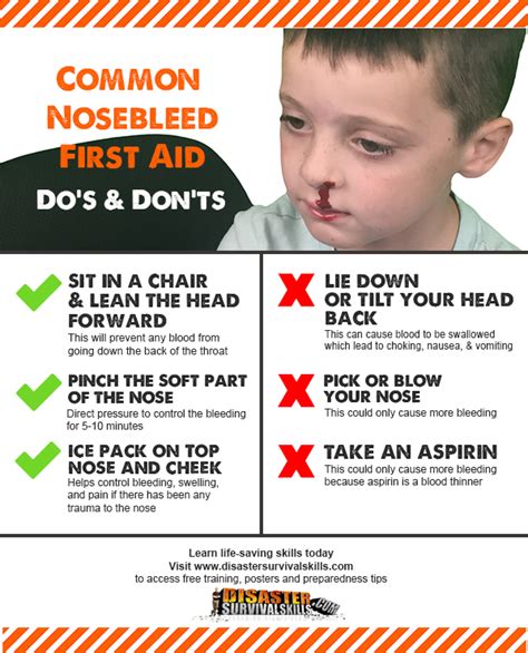 Effective Ways to Stop a Nosebleed Quickly at Home