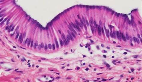 Stratified columnar epithelium, light micrograph Stock