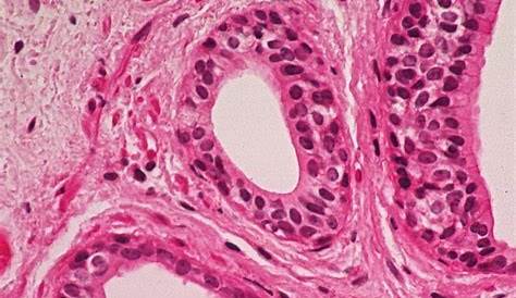 Stratified Cuboidal epithelium xc views of gland. White