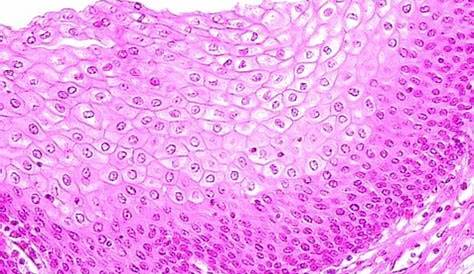 Stratified Squamous Epithelial Tissue Under Microscope Epithelium Stock Photo Image Of