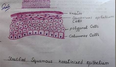 Stratified Squamous Epithelium Keratinized Drawing Schematic (top) And Actual Image (bottom) Of