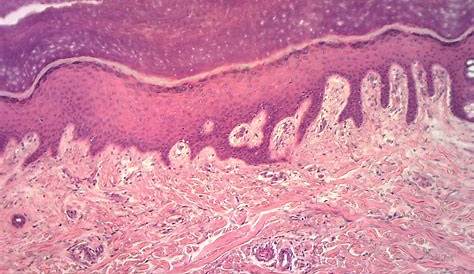 Stratified Squamous Epithelium Keratinized Skin Slide