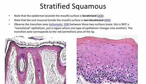 Keratinized vs. Nonkerantinized Stratified Squamous