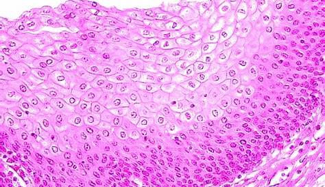 Stratified Squamous Epithelium Tissue Under Microscope Micropedia