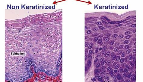 Stratified Squamous Non Keratinized Epithelium Layers Vagina keratinized 100x