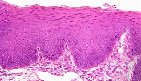 Stratified Squamous Tissue 011. Epithelium (Esophagus)