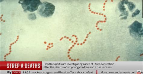 Strep Infection Deadly
