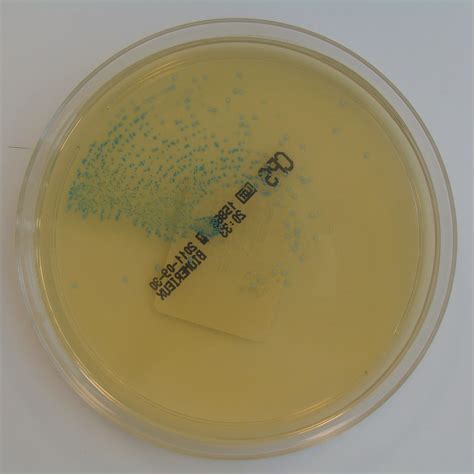 streptococcus agalactiae group b in urine