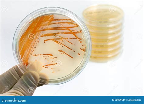 streptococcus agalactiae medio de cultivo