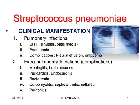 streptococcus pneumoniae bacteremia icd 10