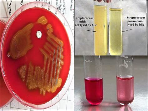 streptococcus pneumoniae biochemical tests