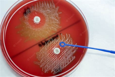 streptococcus pneumoniae blood test