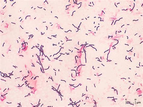 streptococcus pneumoniae gram negative