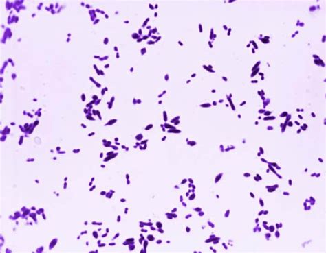 streptococcus pneumoniae habitat