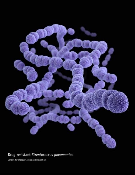 streptococcus pneumoniae invasive disease