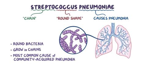 streptococcus pneumoniae is a common cause of