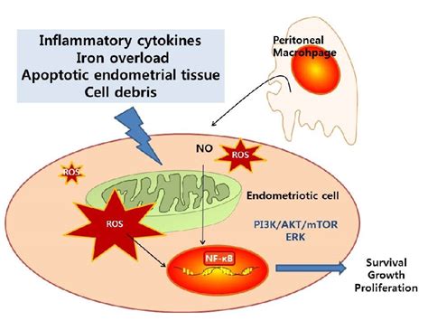 stress and endometriosis pain