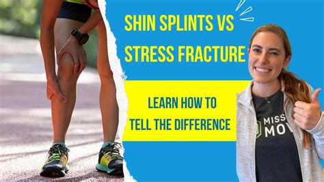 stress fracture vs shin splints