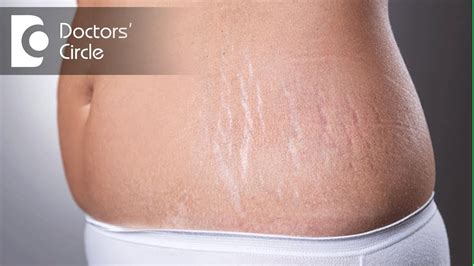 Laser Skin Resurfacing Wall Street Dermatology