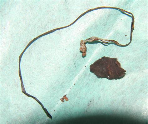 Strings In Child's Stool