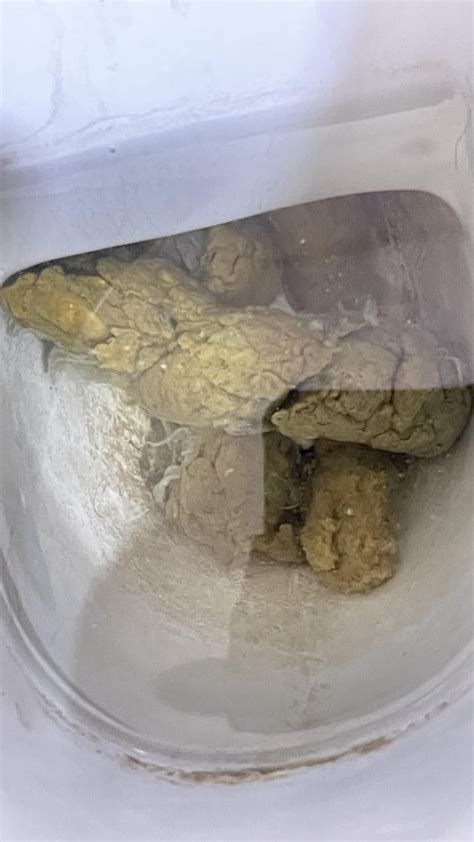 Strings In Poop Reddit