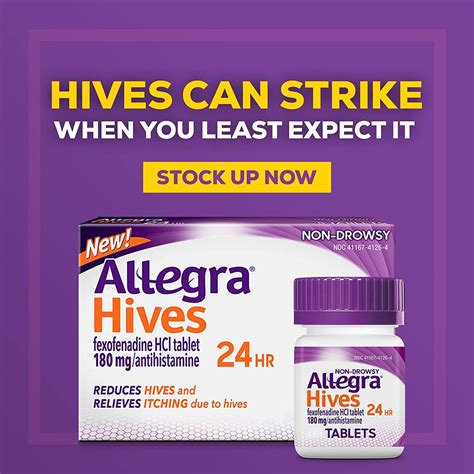 strongest antihistamine for hives
