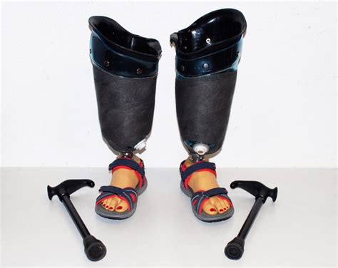 stubby prosthetic feet