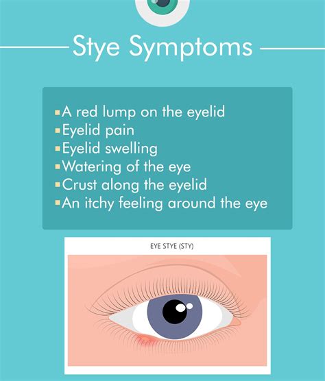 sty eye meaning