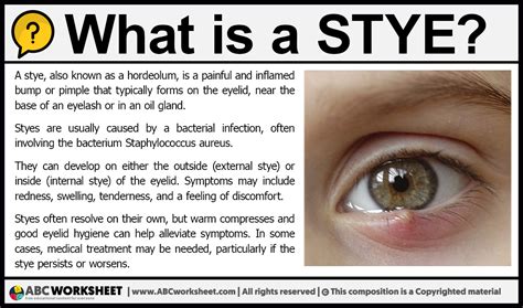 sty meaning in urdu