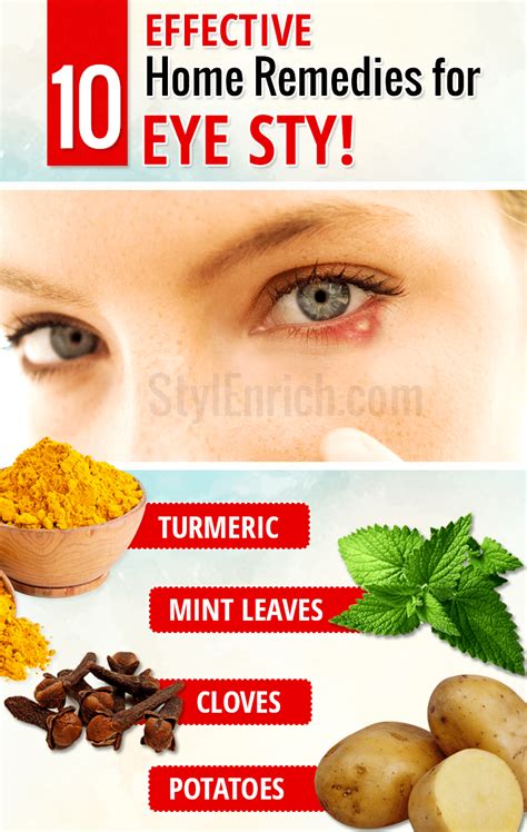 stye eye infection treatment home remedies