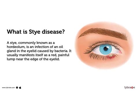 stye in eye meaning